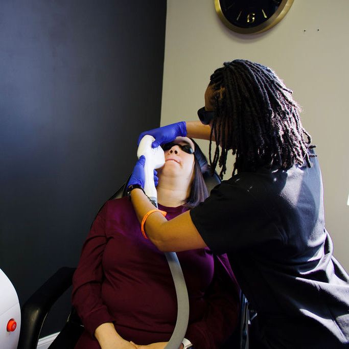 laser hair removal